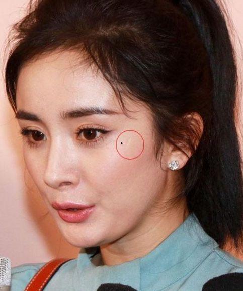 脸上有凹疤的女明星,揭秘拥有独特魅力的凹疤女明星