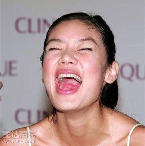 哪些明星蛀牙,蛀牙问题不容忽视